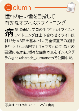 アセット 3