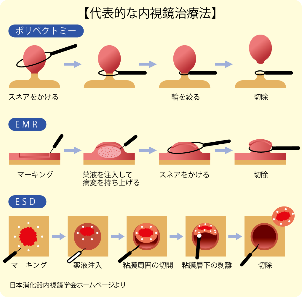 case7_kuma-cyuoアセット 5